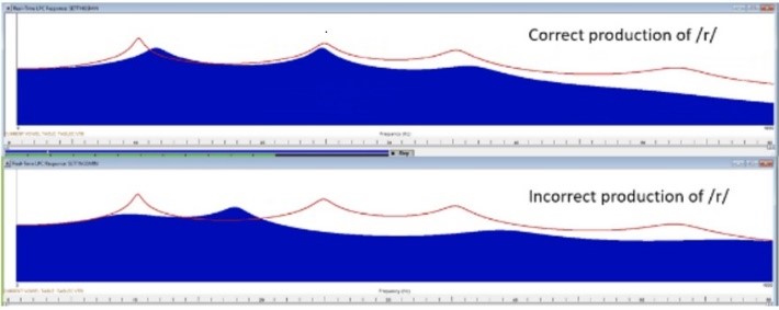 Figure 1. Visual-acoustic biofeedback. A visual graph
