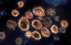 An electron microscope image of SARS-CoV-2 virus particles that cause COVID-19.