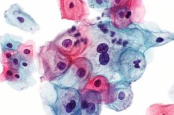 purple, blue and pink cells