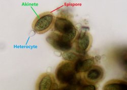 heterocyte, akinete, epsipore