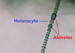 heterocyte and akinetes