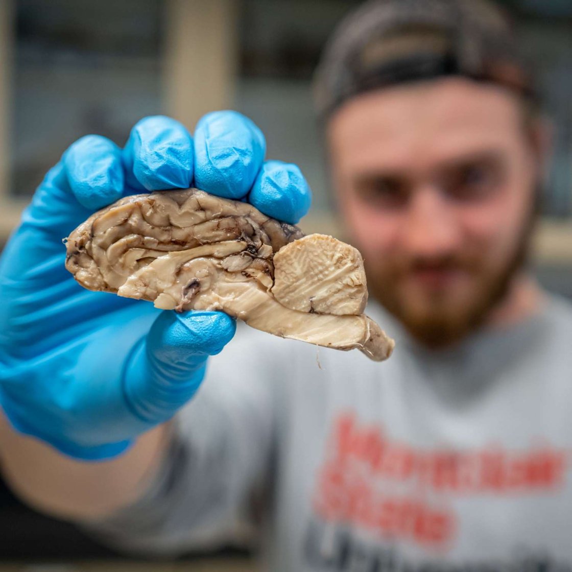 Student holding up a disected brain.