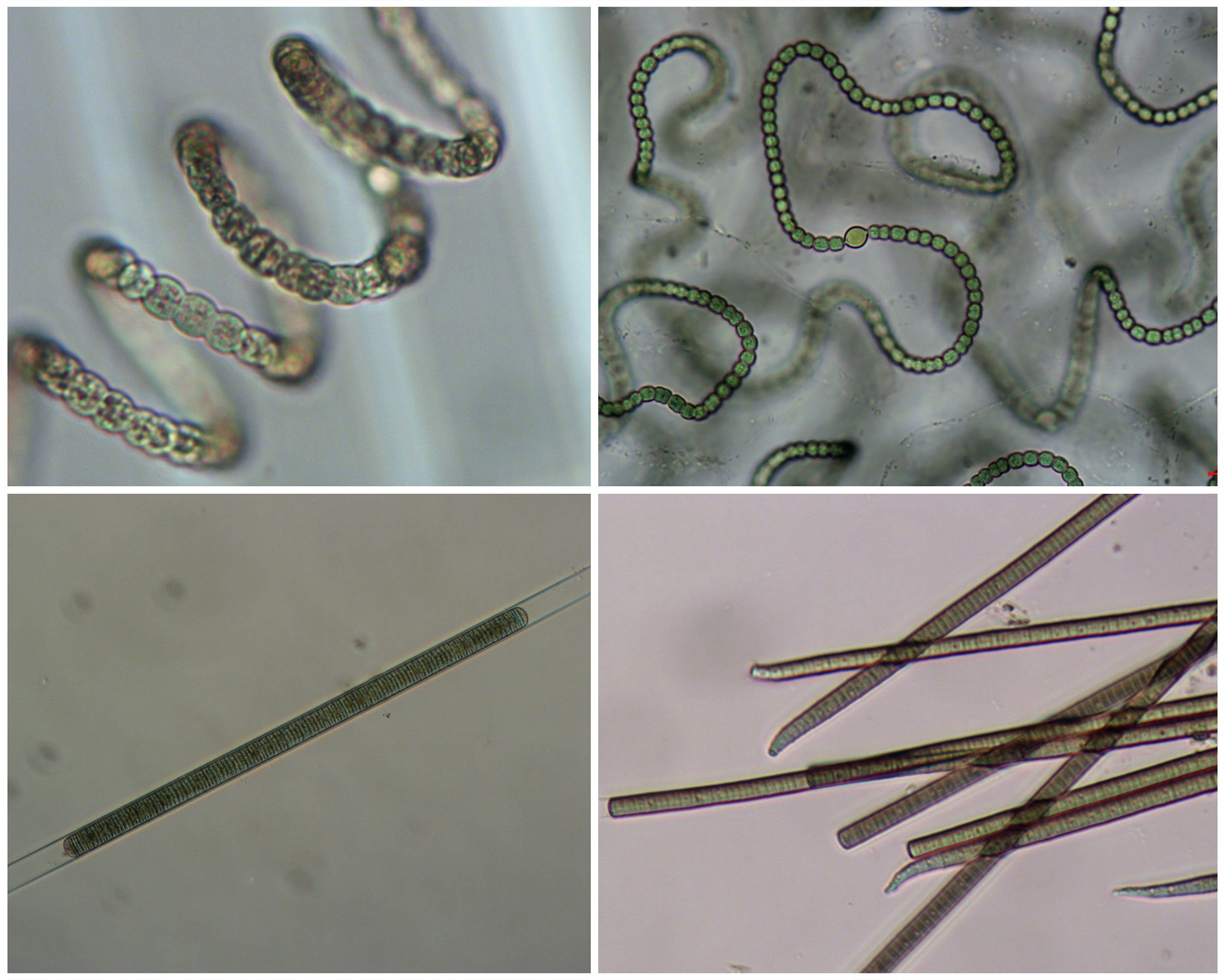 Visual Guide To Cyanobacteria In New Jersey New Jersey Center For